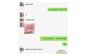 100g的攻击大概是多少钱一天？